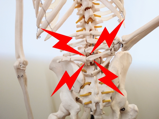 強直性脊椎炎による痛みや体のこわばりの対策方法！